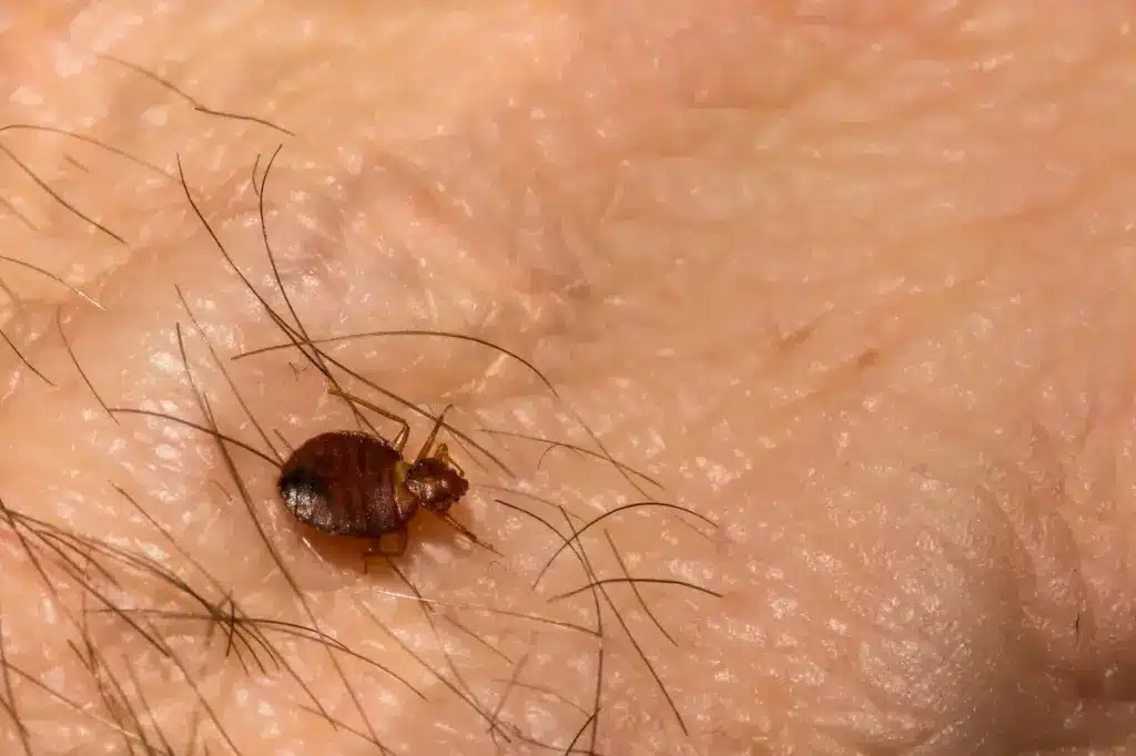 Common Bed Bug on the Human Hair 